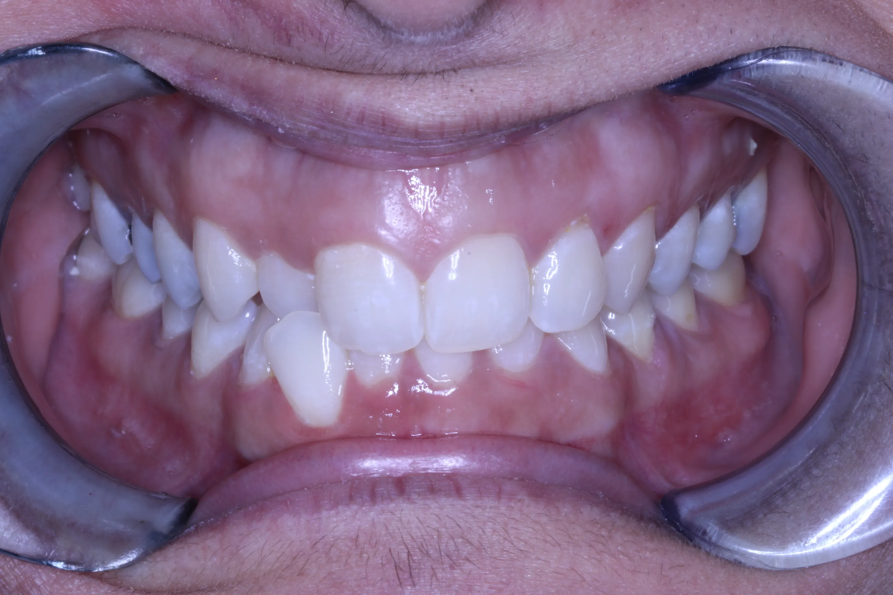 smile-gallery gallery